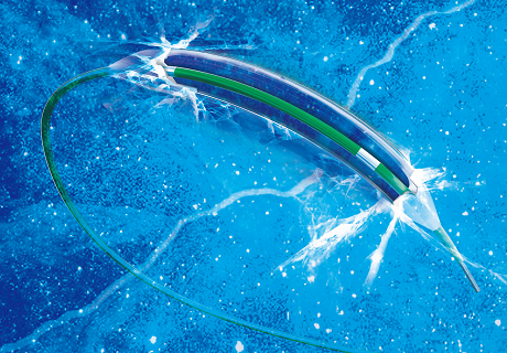 BrosMed Enters USA Coronary Angioplasty Catheter Market