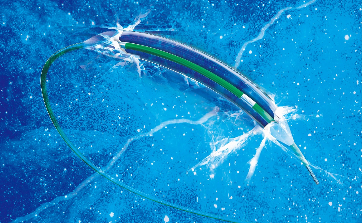 BrosMed Announces FDA 510(k) Clearance and Launch for Apollo™ Balloon Dilatation Catheter in the North America and Global Market